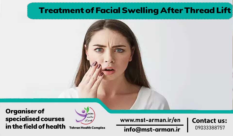 Treatment of Facial Swelling After Thread Lift how to reduce swelling