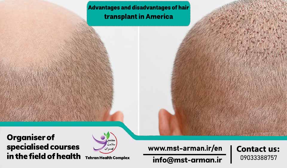 Hair transplant courses in USA MST English Site