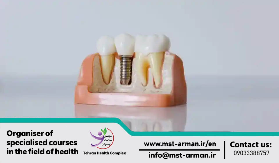 How are dental implants applied