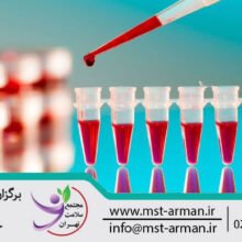 Blood test article | مقاله آزمایش خون