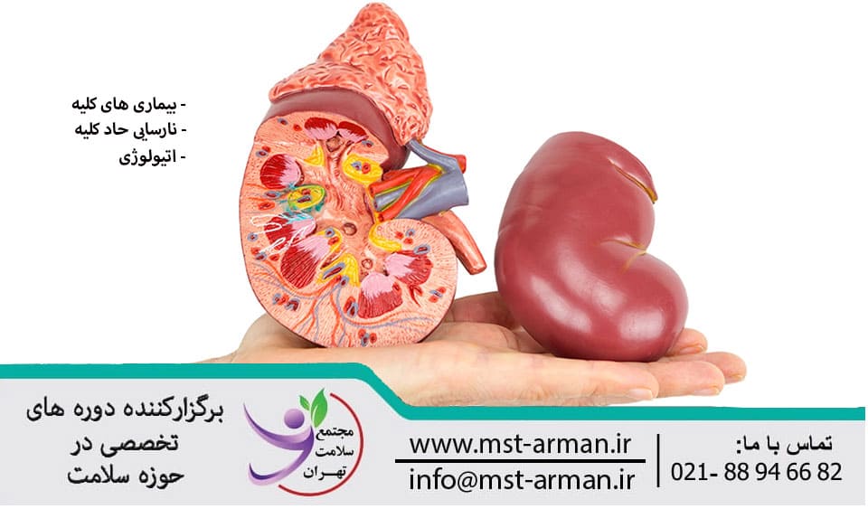 What are 5 diseases that affect the kidney? | تعریف نارسایی کلیه | بیماری حاد کلیوی | موارد حیاتی درباره بیماری کلیه