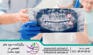 Oral and maxillofacial surgery | جراحی دهان و فک