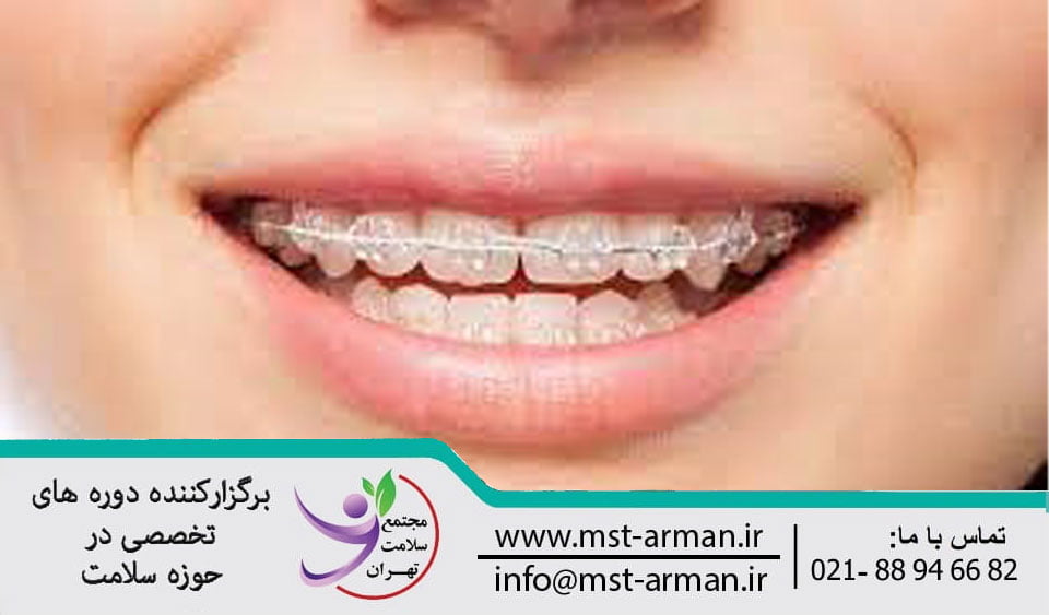 Dental-orthodontics | ارتودنسی دندان