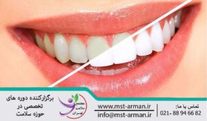 What is restorative dentistry | دندانپزشکی ترمیمی