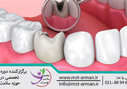 Dental pulpotomy | پالپوتومی دندان