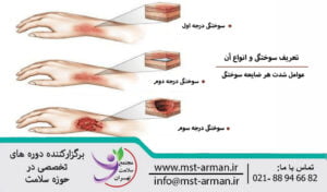 What are the types of burns? | تعریف سوختگی و انواع آن