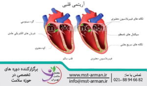 بیماری قلبی عروقی | about Cardiac arrhythmia