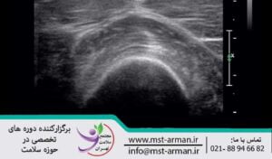 Description of the ultrasound mechanism | توضیحات مکانیسم سونوگرافی