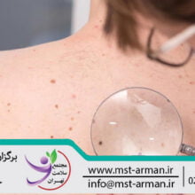 Common skin disease |بیماری شایع پوستی