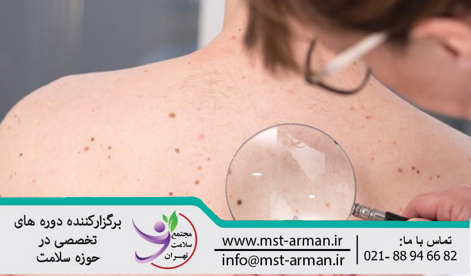 Common skin disease |بیماری شایع پوستی