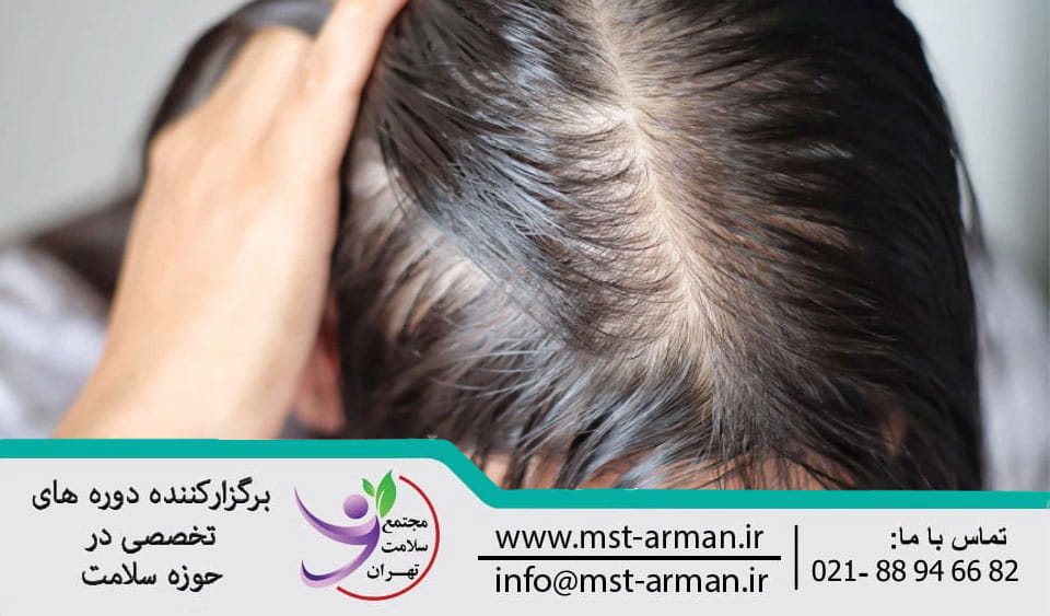 Causes of hair root damage | علت آسیب به پیاز مو بعد از کاشت مو چیست