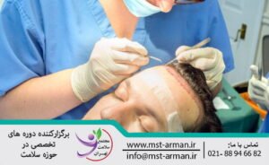 Causes of numbness after hair transplant | علل بی حسی بعد از کاشت مو
