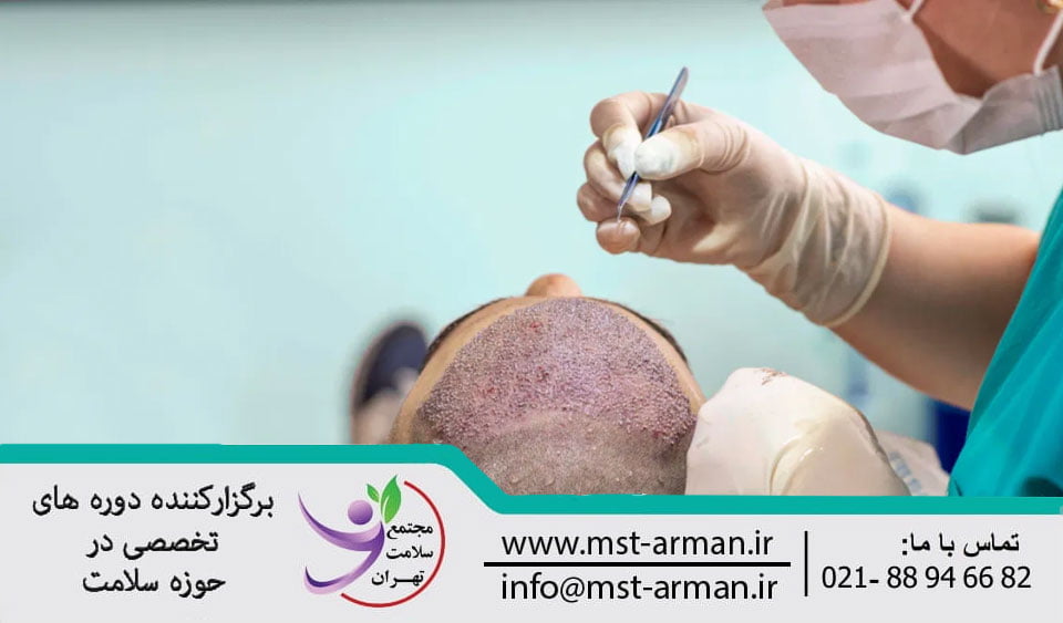 FUT method in hair transplantation | روش کاشت موی FUT