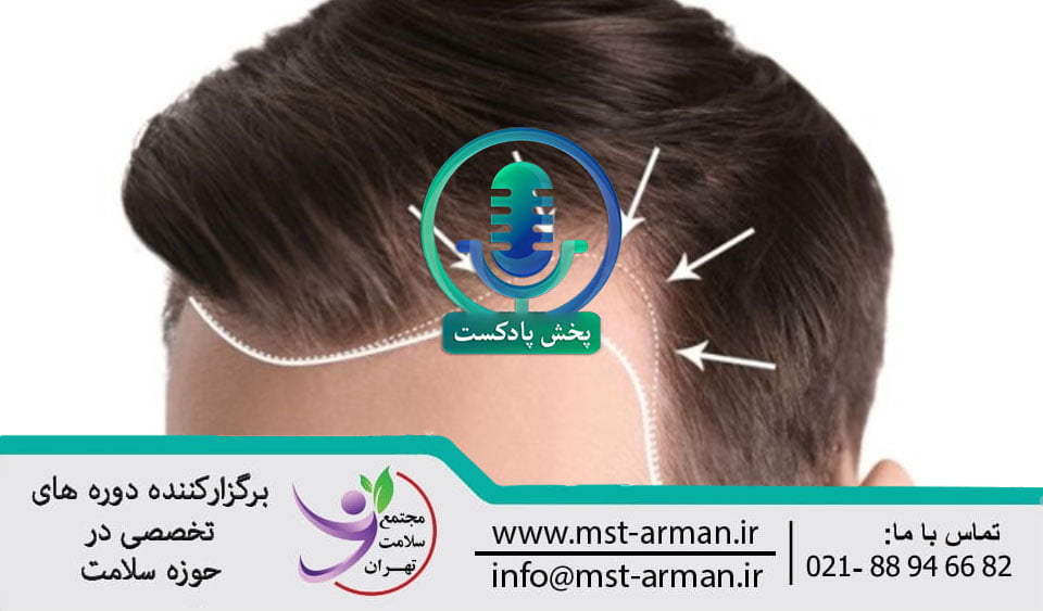 Dissatisfaction with the design of the hair transplant line | عدم رضایت طراحی خط کاشت مو