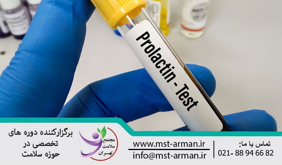 What is the prolactin hormone test? | تست هورمون پرولاکتین یا هورمون شیر چیست