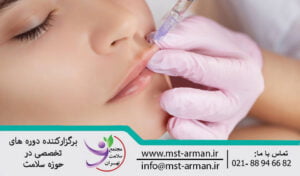 درمان خطوط شعاعی اطراف لب ها با فیلر درمی | Treatment of radial lines around the lips with dermal filler