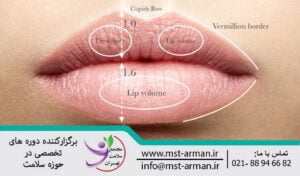 Filler injection in the body of the lip | تزریق فیلر درمی در جسم لب جهت درمان و افزایش حجم