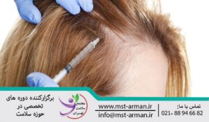 Hair loss treatment with mesotherapy | درمان ریزش مو با مزوتراپی