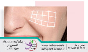 افزایش حجم گونه با فیلر | Injectable filler to increase cheek volume