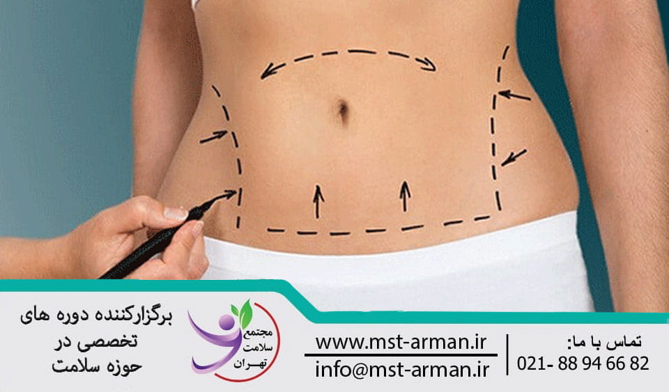 Removal of local obesity and cellulite with mesotherapy | رفع چاقی موضعی و درمان سلولیت با مزوتراپی