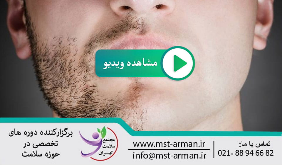 Repairing and implanting beard and sibyl in men | ترمیم و کاشت ریش و سیبیل درآقایان
