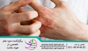 Treatment of damaged skin | درمان پوست دچار آسیب 