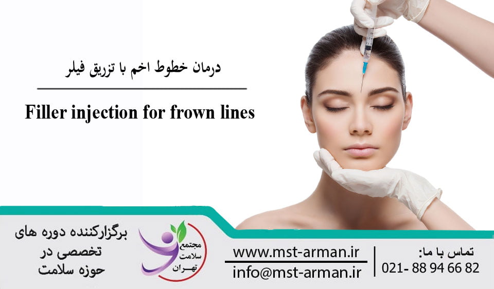 Treatment of frown lines with filler | درمان خطوط اخم با فیلر