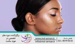 گونه گذاری با تزریق فیلر | Injectable filler to increase cheek volume