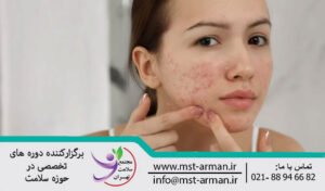The role of micro needling in the treatment of acne scars | جایگاه میکرونیدلینگ در درمان اسکار آکنه