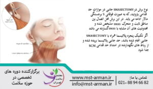 برش گسترده SMASECTOMY | CUT SMASECTOMY