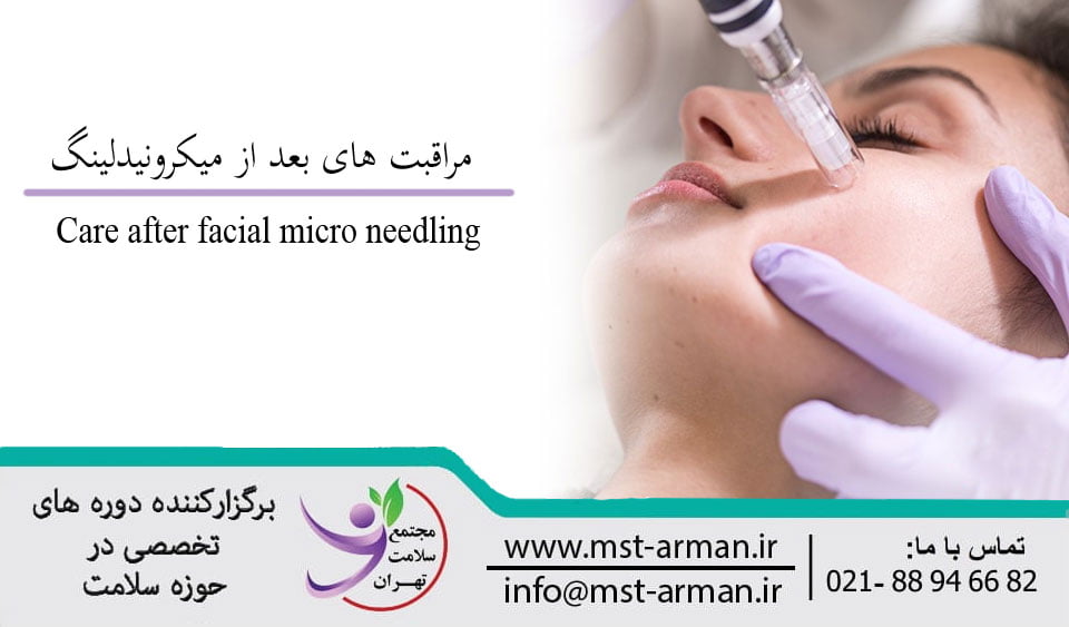 Care after facial micro needling | مراقبت های قبل و بعد میکرونیدلینگ
