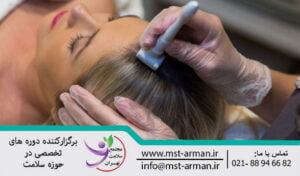 مراقبت های بعد از میکرونیدلینگ مو | Care after hair micro needling