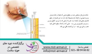 Facial marginal branch | انشعاب عصبی مارژینال در صورت