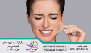 Layer on Jessner | لایه بر جسنر