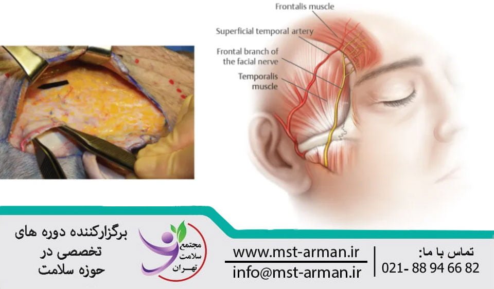 Superficial temporal artery | شریان سطحی گیجگاهی