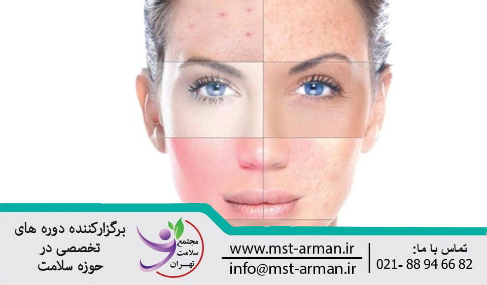 The benefits of microdermabrasion and its contraindications | فواید و موارد منع میکرودرم