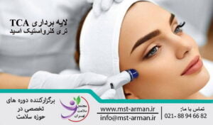 Trichloroacetic acid layer | لایه برداری با تری کلرواستیک اسید
