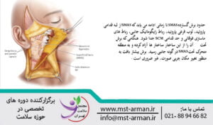 Wide cut SMAS | برش گسترده SMAS