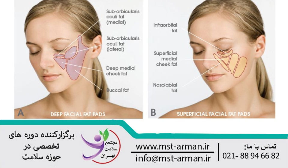 قسمت بندی کمپارتمان های چربی سطحی