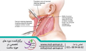 retaining ligaments of face | رباط های نگهدارنده صورت و گردن