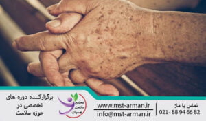 All about hyperpigmentation | همه چیز درباره هیپرپیگمانتاسیون