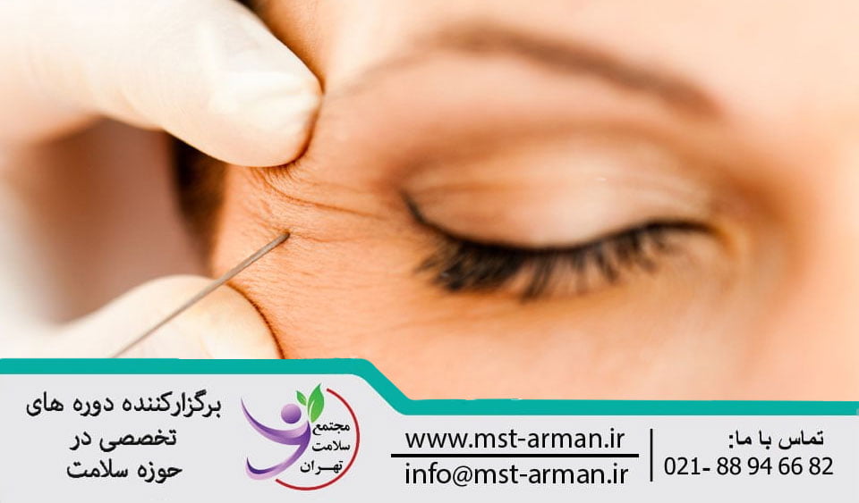 عوارض تزریق بوتاکس در خطوط گوشه چشم | Complications of Botox injection in the lines of the corners of the eyes