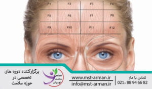 Botox injection areas in the horizontal lines of the forehead | مناطق تزریق بوتاکس در پیشانی