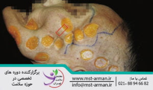 Histological findings in the aortic arch region| یافته بافت شناسی در ناحیه کمان آئورتی