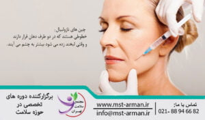 Dangerous nasolabial area | تزریق در ناحیه خطرناک نازولبیال