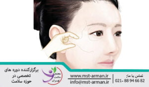 Pinching anatomy: cheekbone area | آناتومی نیشگونی ناحیه کمان گونه ای