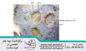Temporal region | ناحیه تمپورال گیجگاهی
