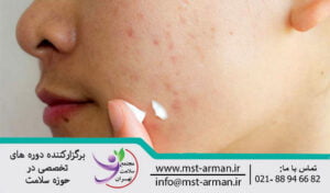 Treatment of side effects of topical compounds | درمان عوارض ترکیبات موضعی