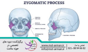 ناحیه کمان زایگوماتیک | Zygomatic arch area