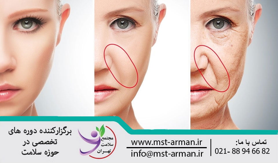 Marionette lift design | طراحی لیفت خطوط ماریونت